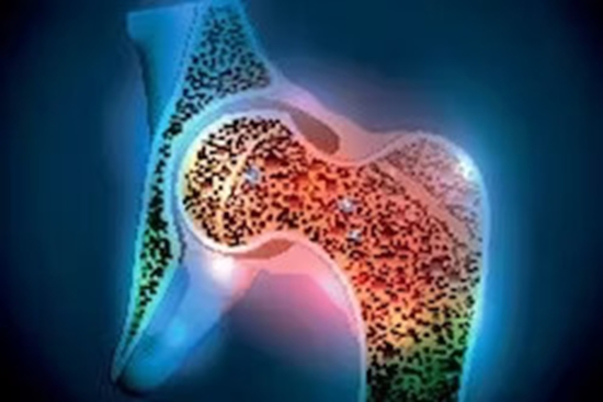 Low Bone Mineral Density and Associated Factors Among People Living With HIV in Kerman Iran A Cross Sectional Study in 2021 2022 {faces}